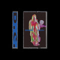 Dopamine Chamber: Cassette