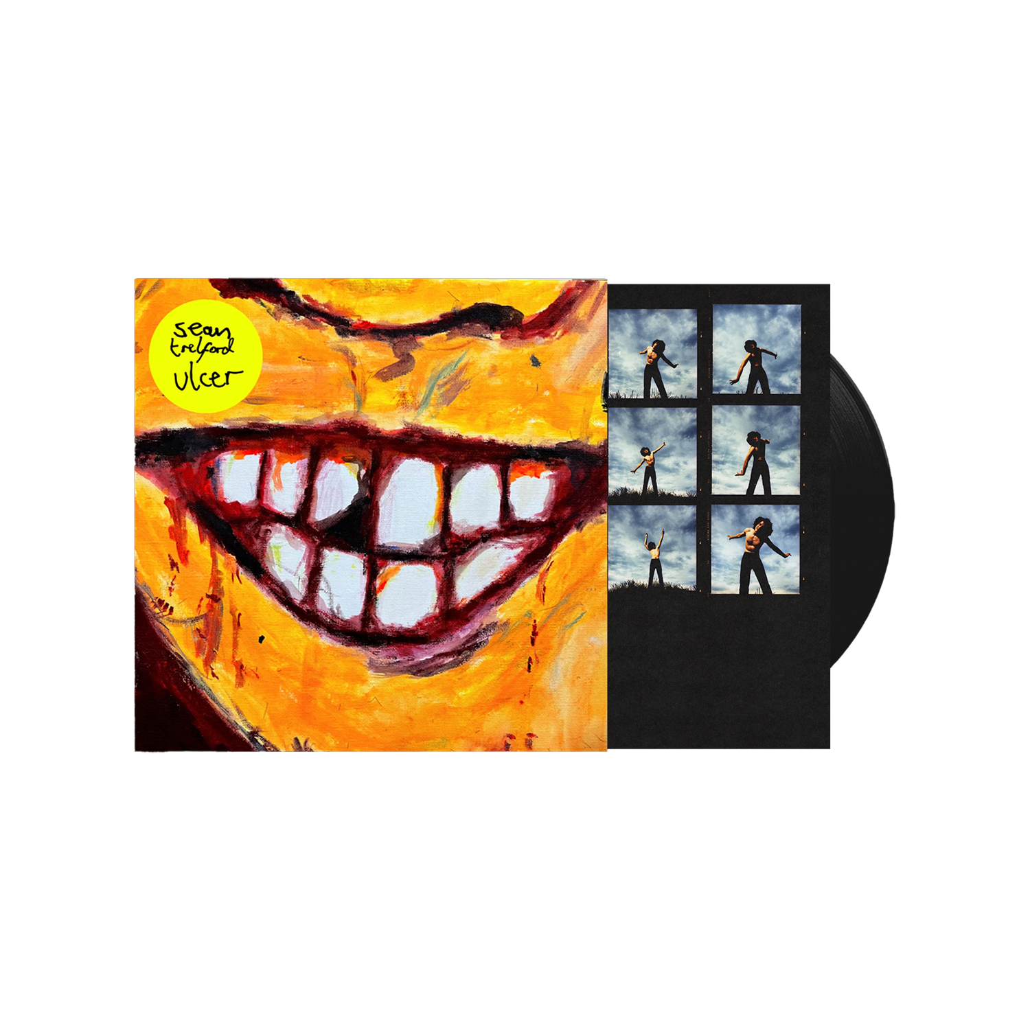 Ulcer Standard LP